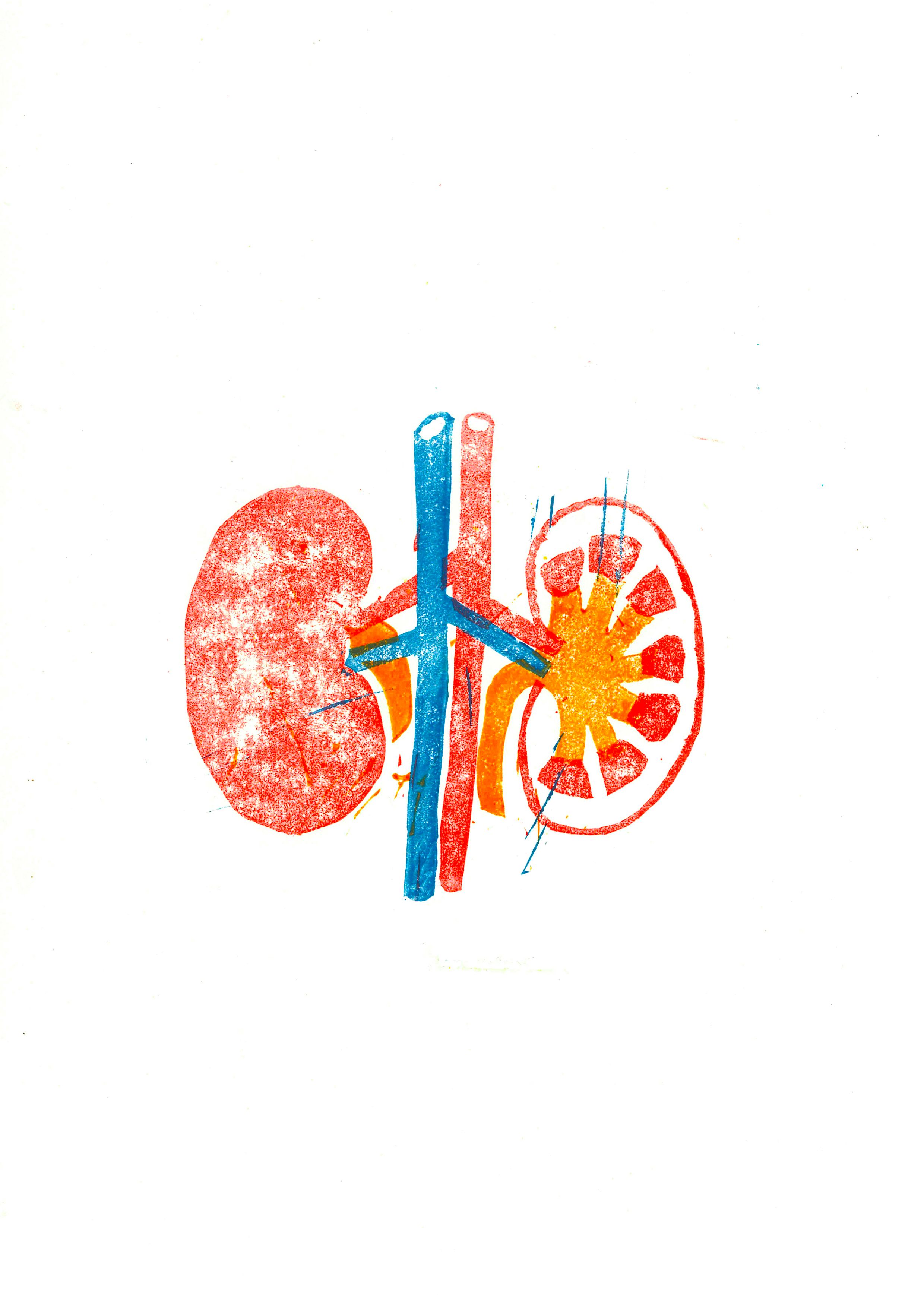 kidney